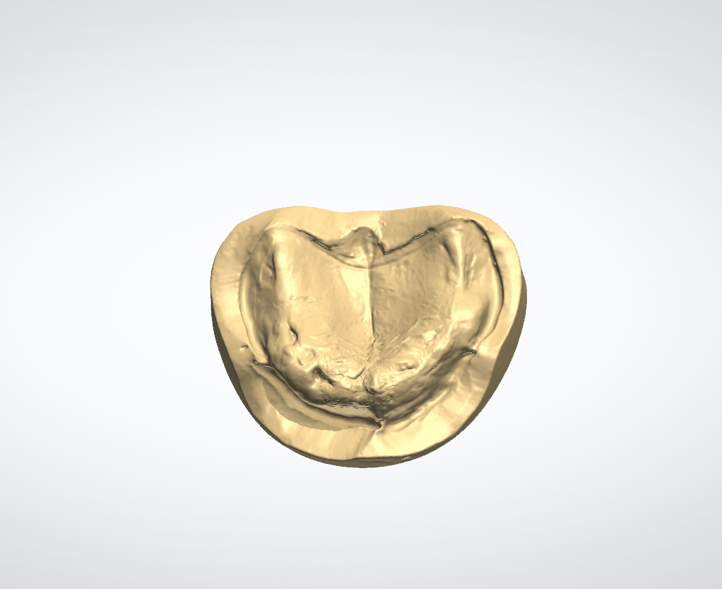 Foto 1 — superiore STL