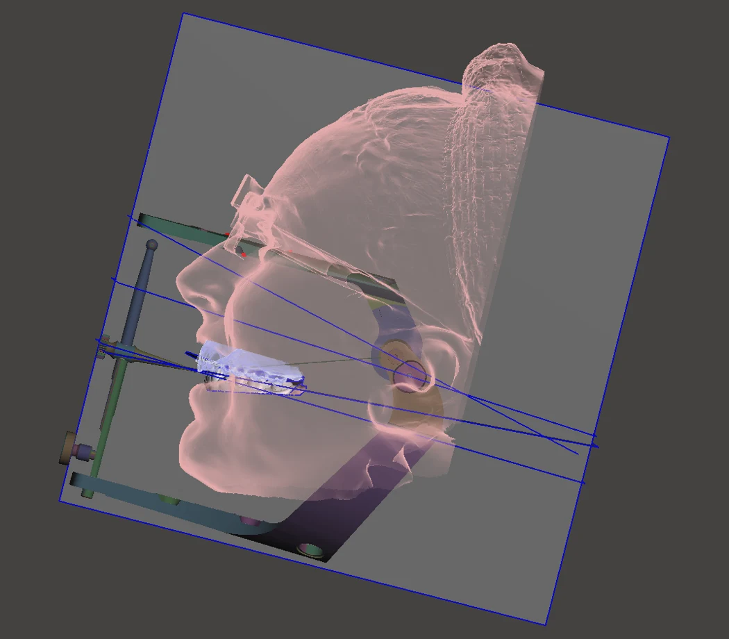 Piani di riferimento e modello digitale individuale del paziente